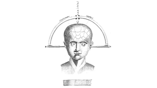 After 120 Years, Doctors Develop New Brain Surgery Technique